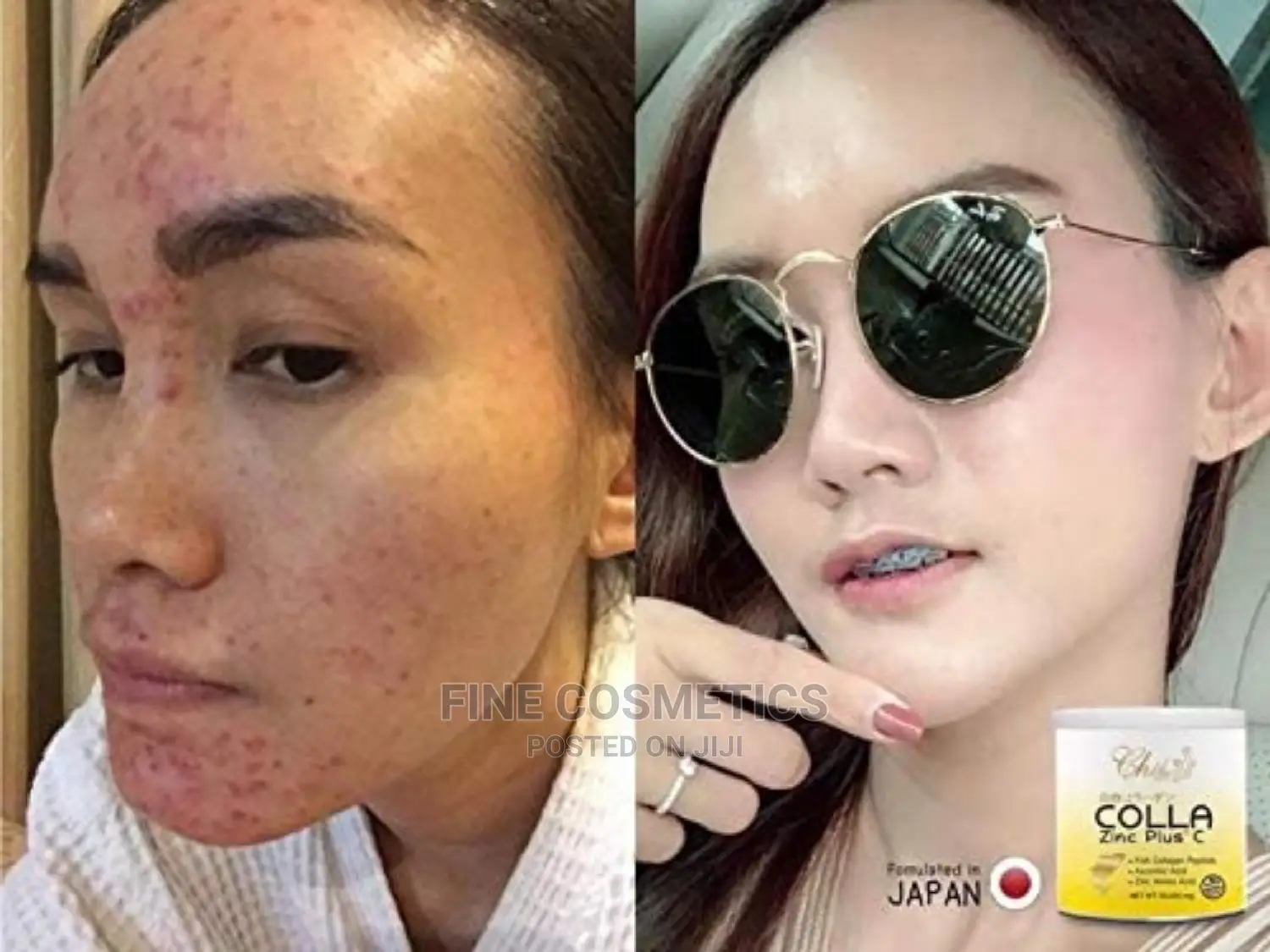 Collagen Powder + Zinc Plus Vitamin C Skin Fish Oil Peptides Ascorbic