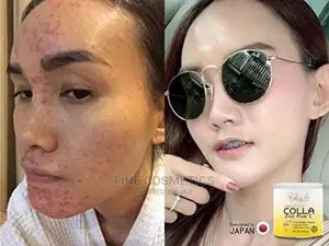 Collagen Powder + Zinc Plus Vitamin C Skin Fish Oil Peptides Ascorbic