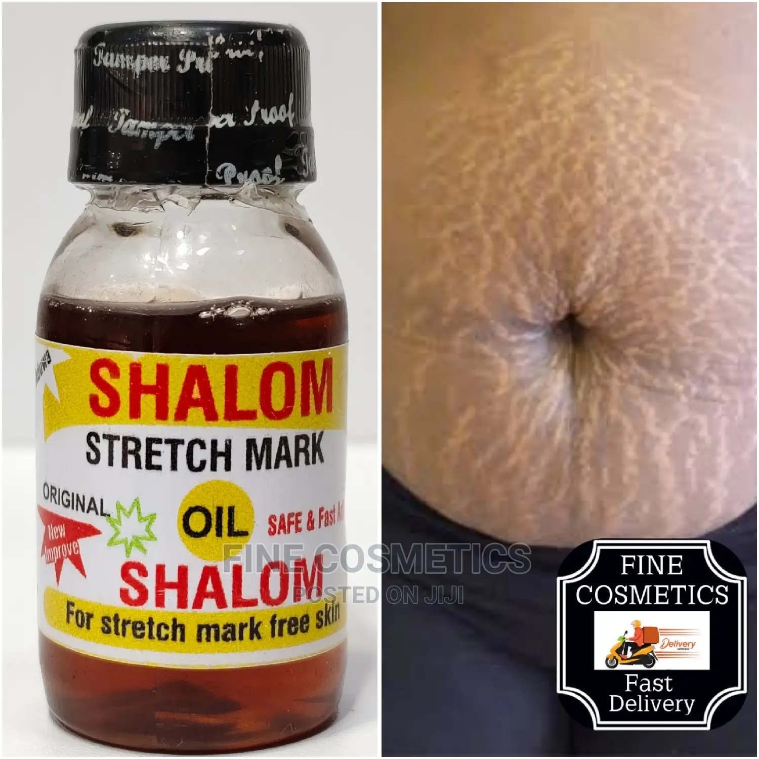 ORIGINAL Shalom OIL 14 Days Stretch Marks Wipeout Oil