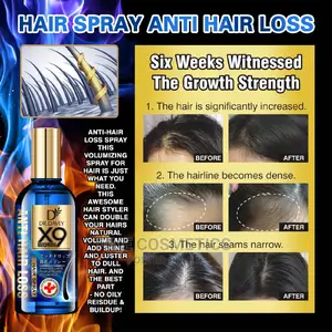Dr Davey X9 Biotin Anti Hair Loss Spray Hair Strengthener