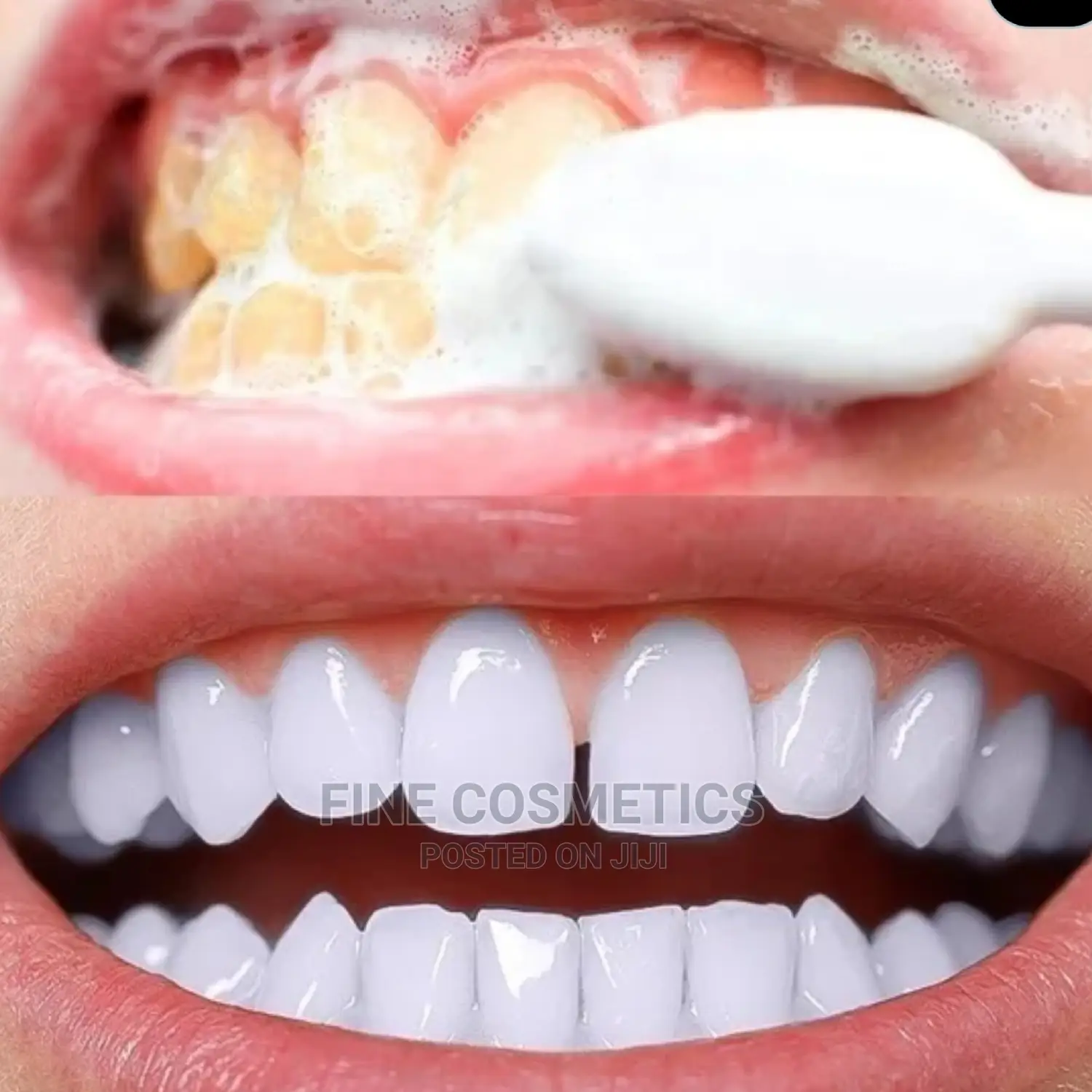 Vaseina Teeth Whitening Essence + Swabs Remove Plaque Stain