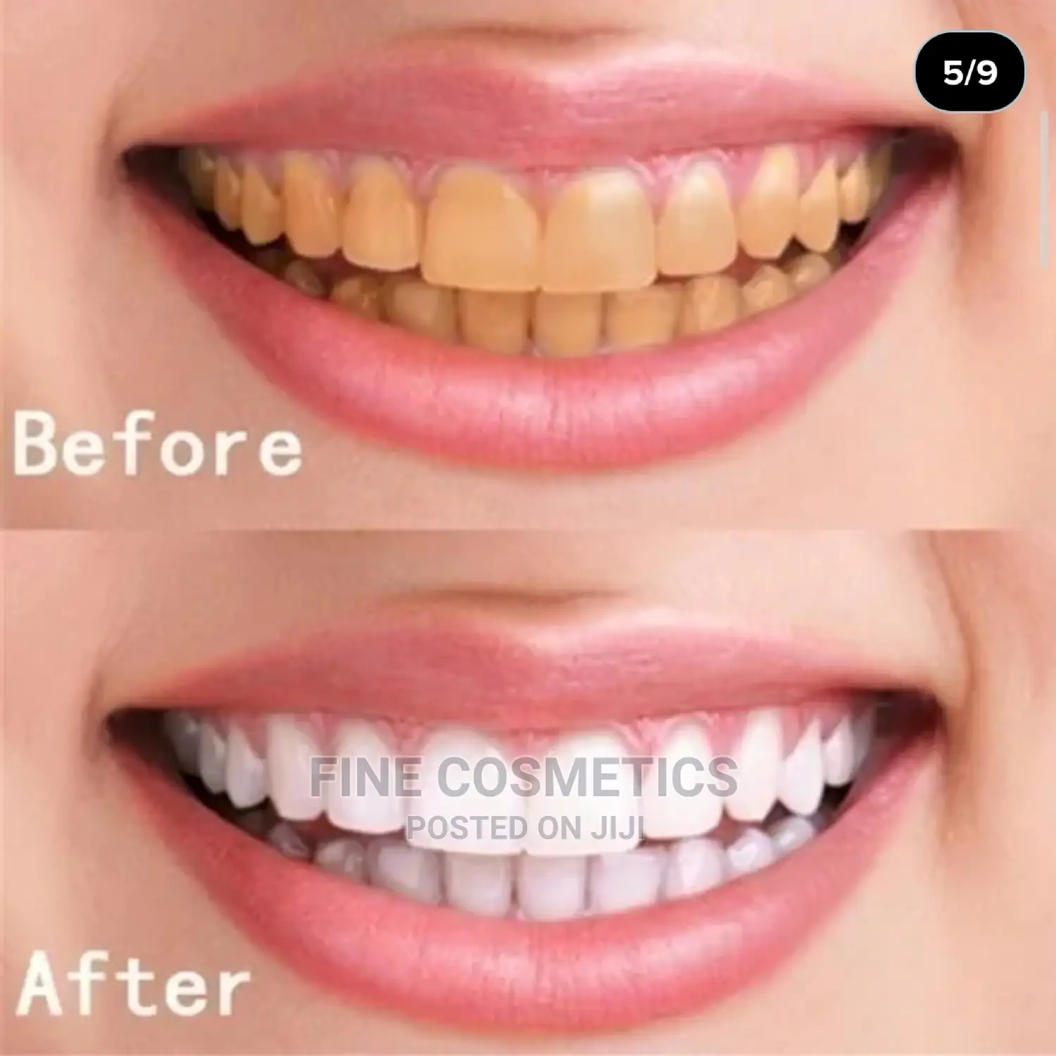 Vaseina Teeth Whitening Essence + Swabs Remove Plaque Stain