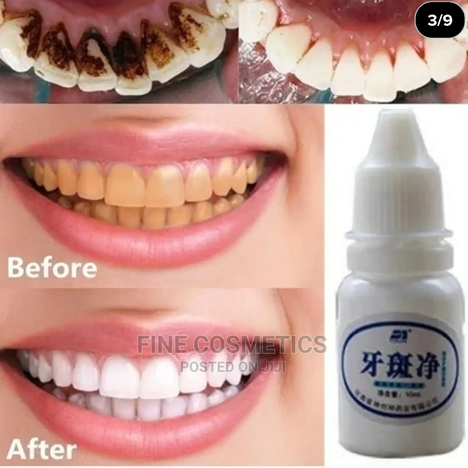 Vaseina Teeth Whitening Essence + Swabs Remove Plaque Stain