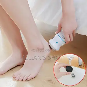Callus Remover