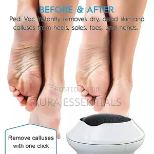 Electric Foot Grinder