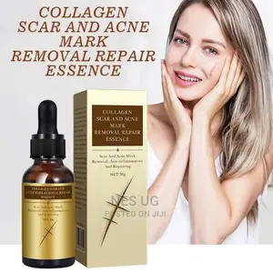 Collagen Scar Acne Mark Removal Repair Essence