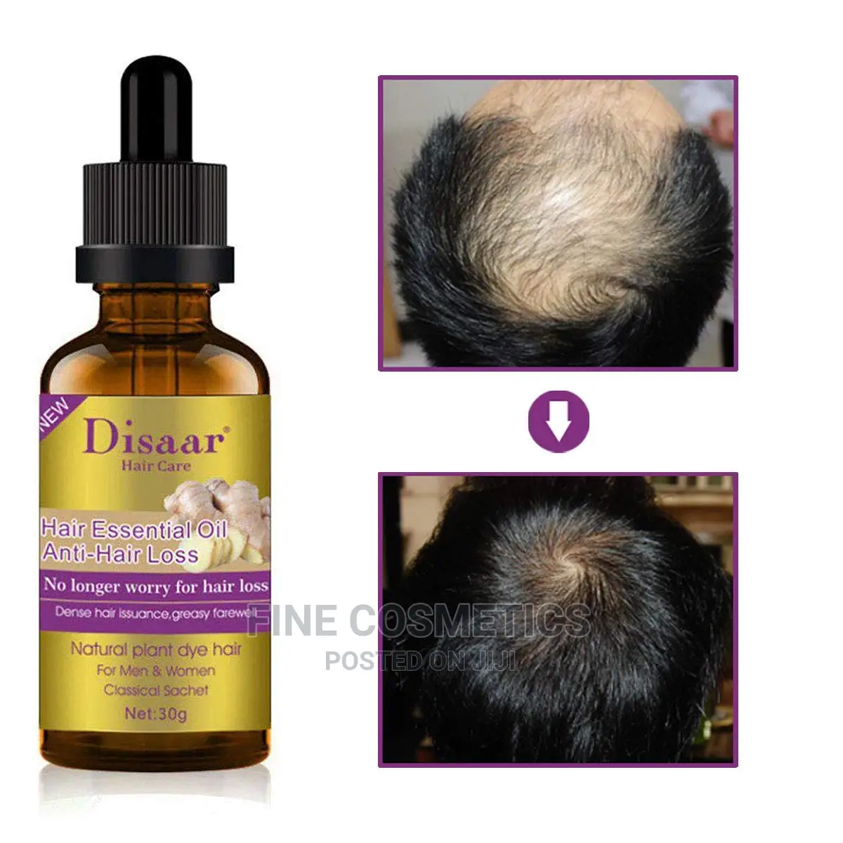 Disaar Hair Care Unisex Essential Oil for Anti Hair Loss 30g