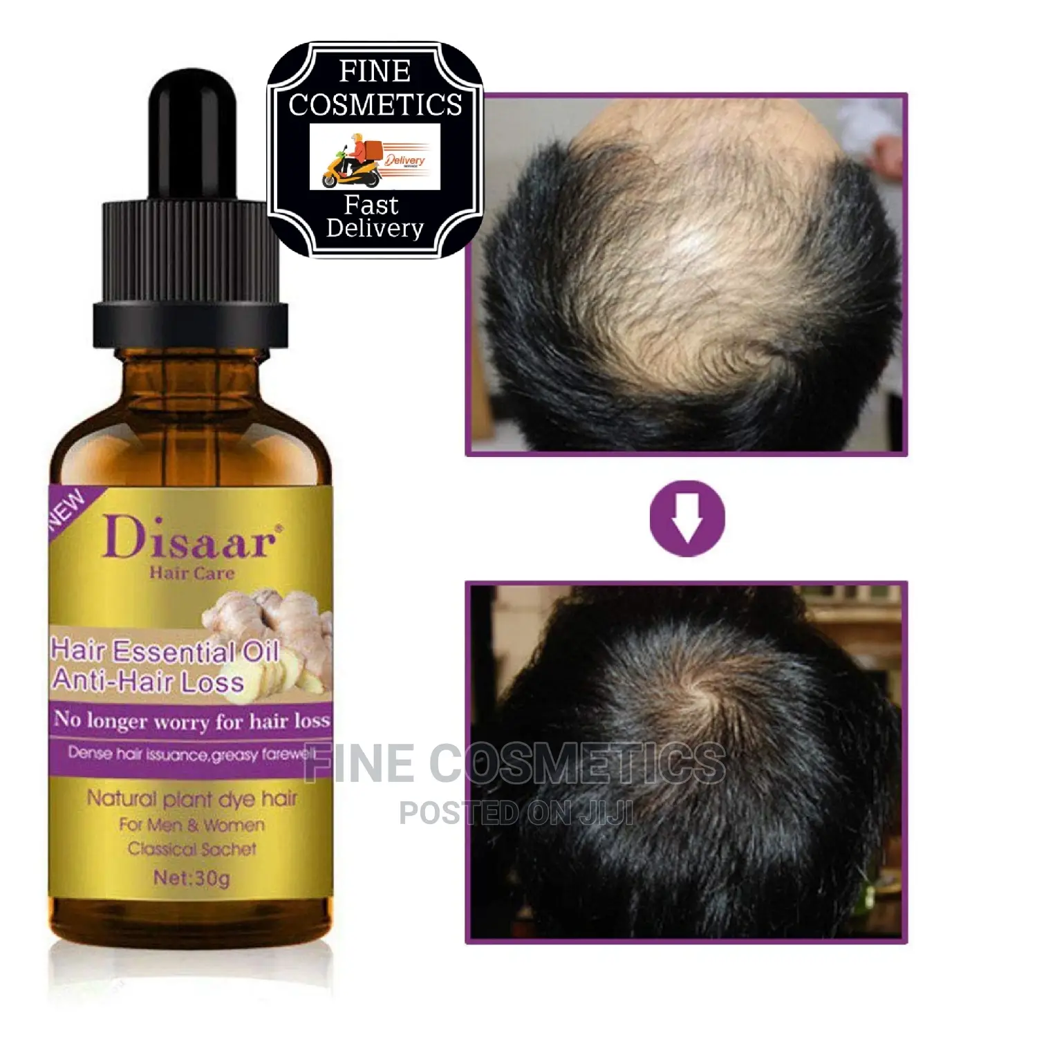 DISAAR Anti-Hair Loss Shampoo and Hair Growth Booster Oil
