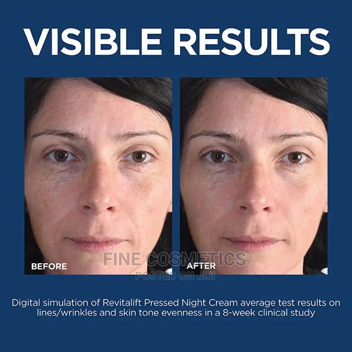Loreal Retino Laser Anti-aging Face Cream With Niacinamide