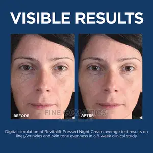 Loreal Retino Laser Anti-aging Face Cream With Niacinamide