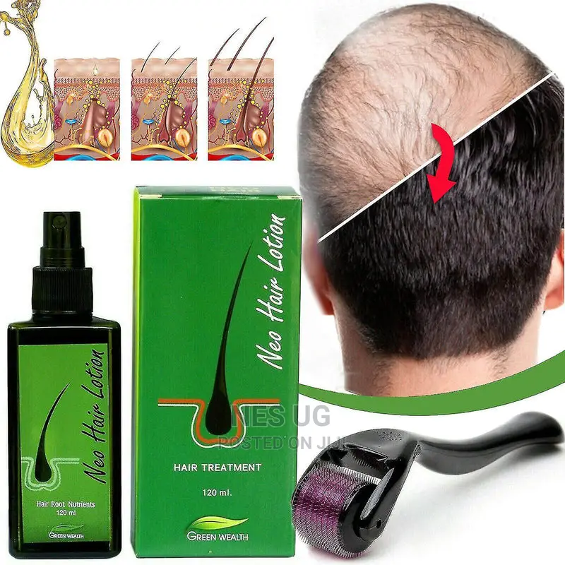 Neo Hair Lotion Hair Treatment Anti Hair Loss Baldness Cure