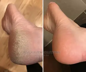Thailand SKIN DOCTOR Heel Balm For Rough| Dry| Cracked| Feet