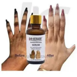Photo - Knuckles and Elbow Remover Serum