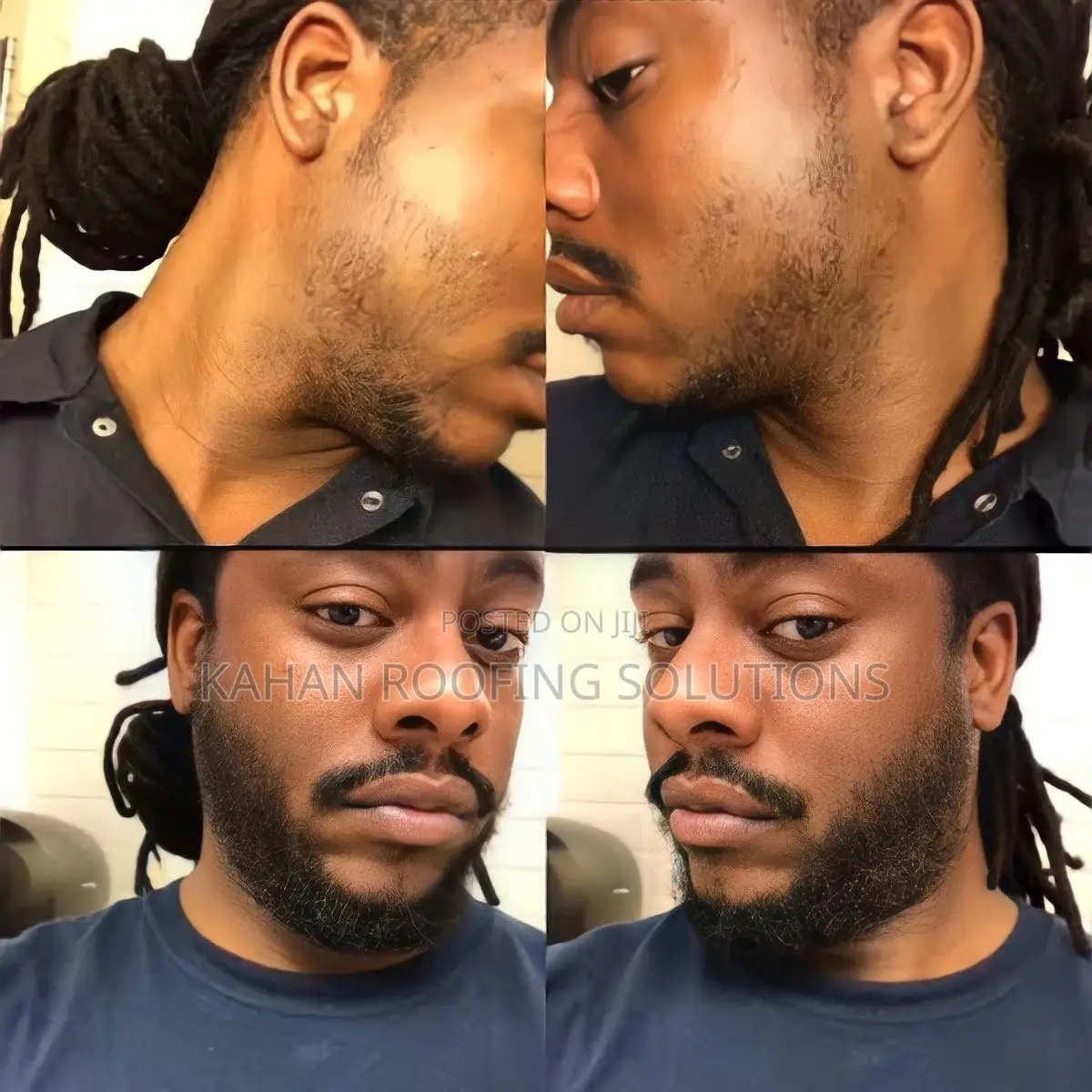 Minoxidil 5% Kirkland Solution