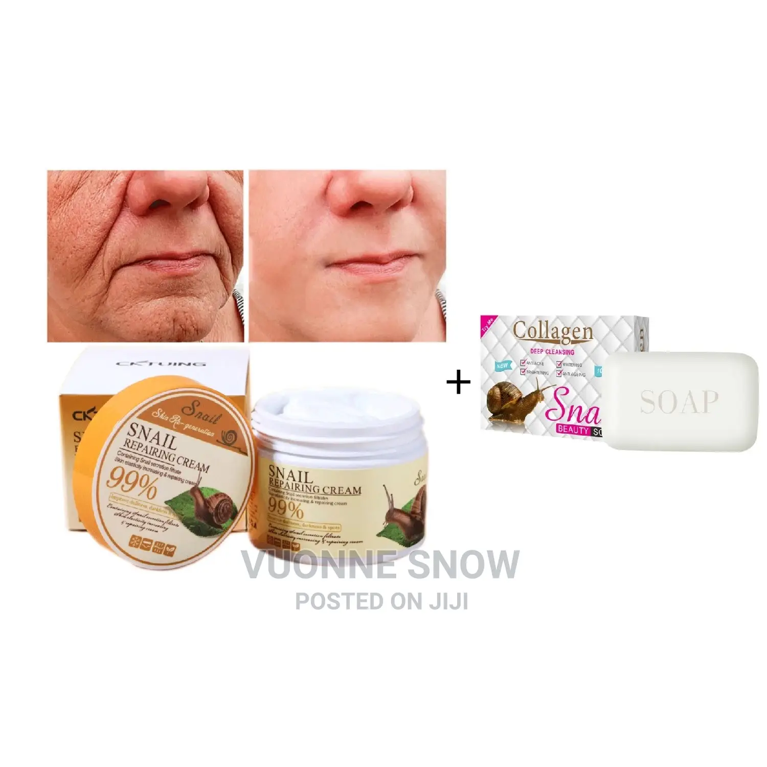 Snails Repair Skin Care Cream+ Snails Soap
