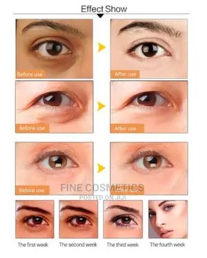 Dr Rashel Gold Collagen Anti Eye-Bags Hydrogel Eye Mask