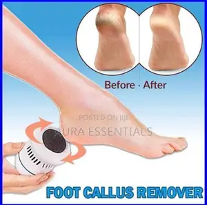 Skin Callus Remover