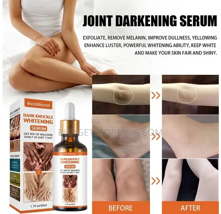 Black Fingers Dark Knees Dark Knuckle Remover