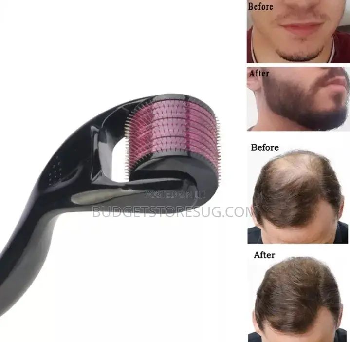 Hair Regrowth Beard Growth Anti-Hair Loss Treatment