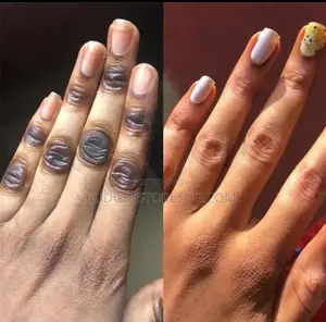 Dark Skin Parts Lightening