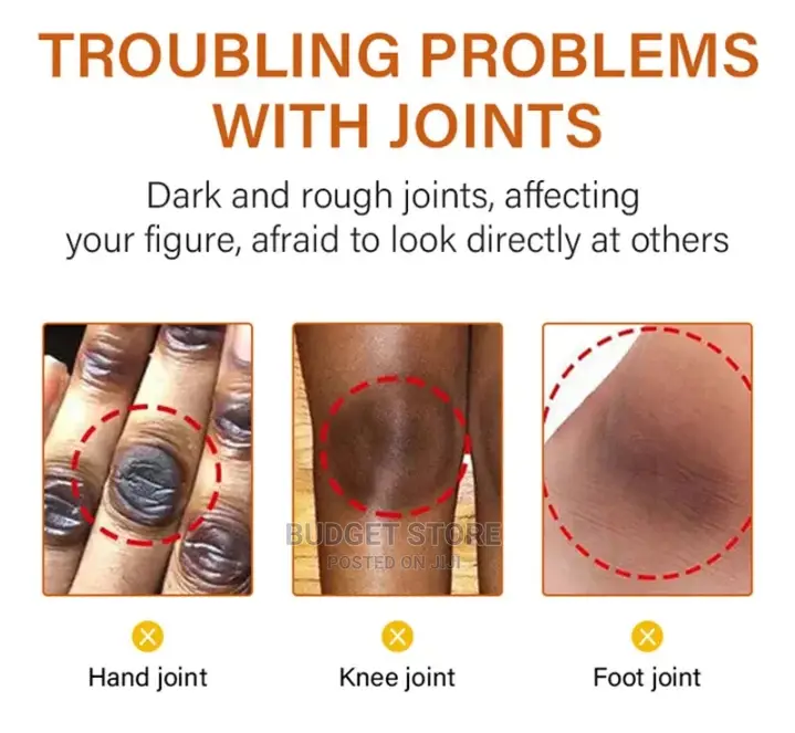 Remove Dark Knuckle Elbow Knee Strong Dark Knuckle