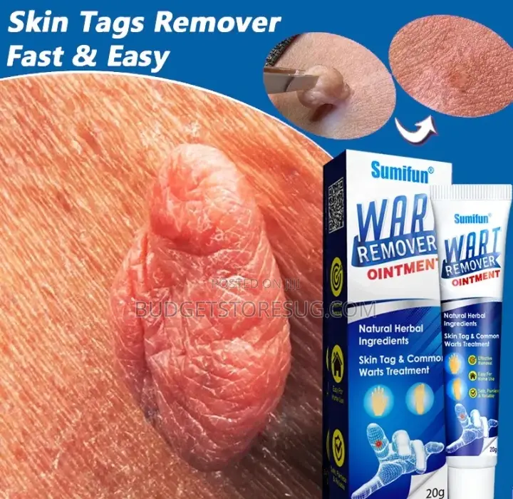 Skin Tag Remover
