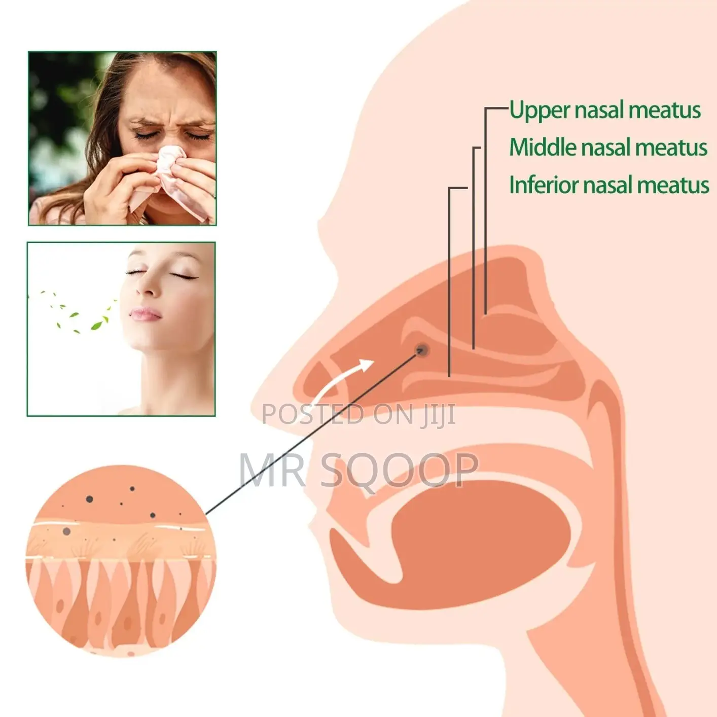 Herbal Spray Nose Congestion Rhinitis Sinus Treatment
