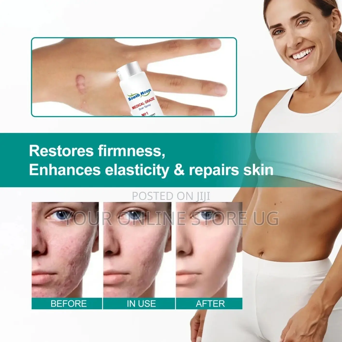 2pcs South Moon Scar Care Spray for Skin Care Routine