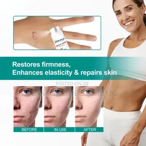 2pcs South Moon Scar Care Spray for Skin Care Routine