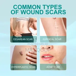 Skin Care Scar Removal Spray Acne Repair