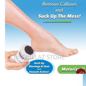 Electric Calluses Remover.