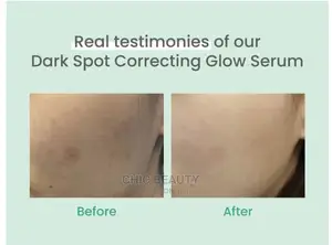 Axis - Y - Dark Spot Correcting Glow Serum for Face