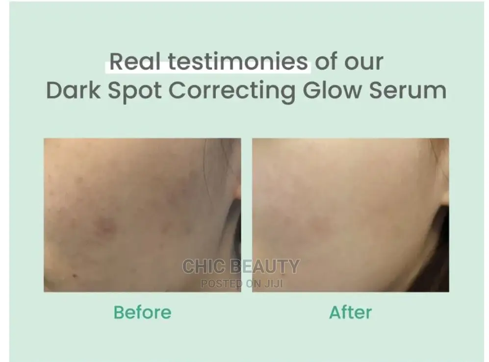 Axis - Y - Dark Spot Correcting Glow Serum for Face