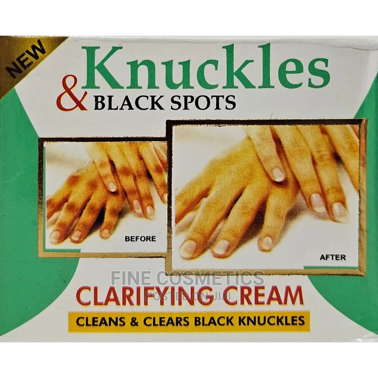 Knuckles and Black Spots Clarifyng Cream Knuckles Remover