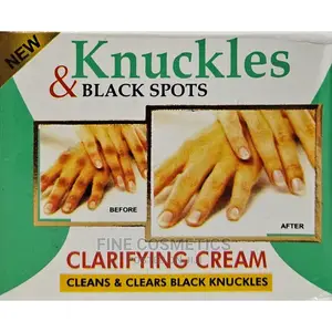 Knuckles and Black Spots Clarifyng Cream Knuckles Remover