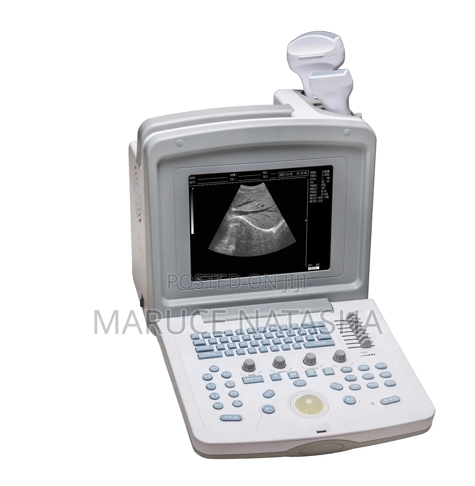 Portable Ultrasound Scan