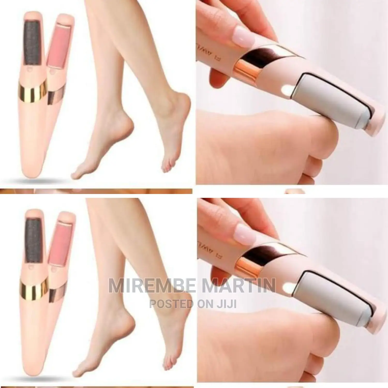 Portable Callus Remover