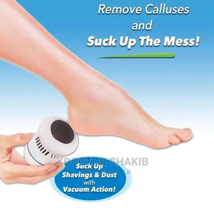 Electronic Foot Pedi Vac Callus Remover