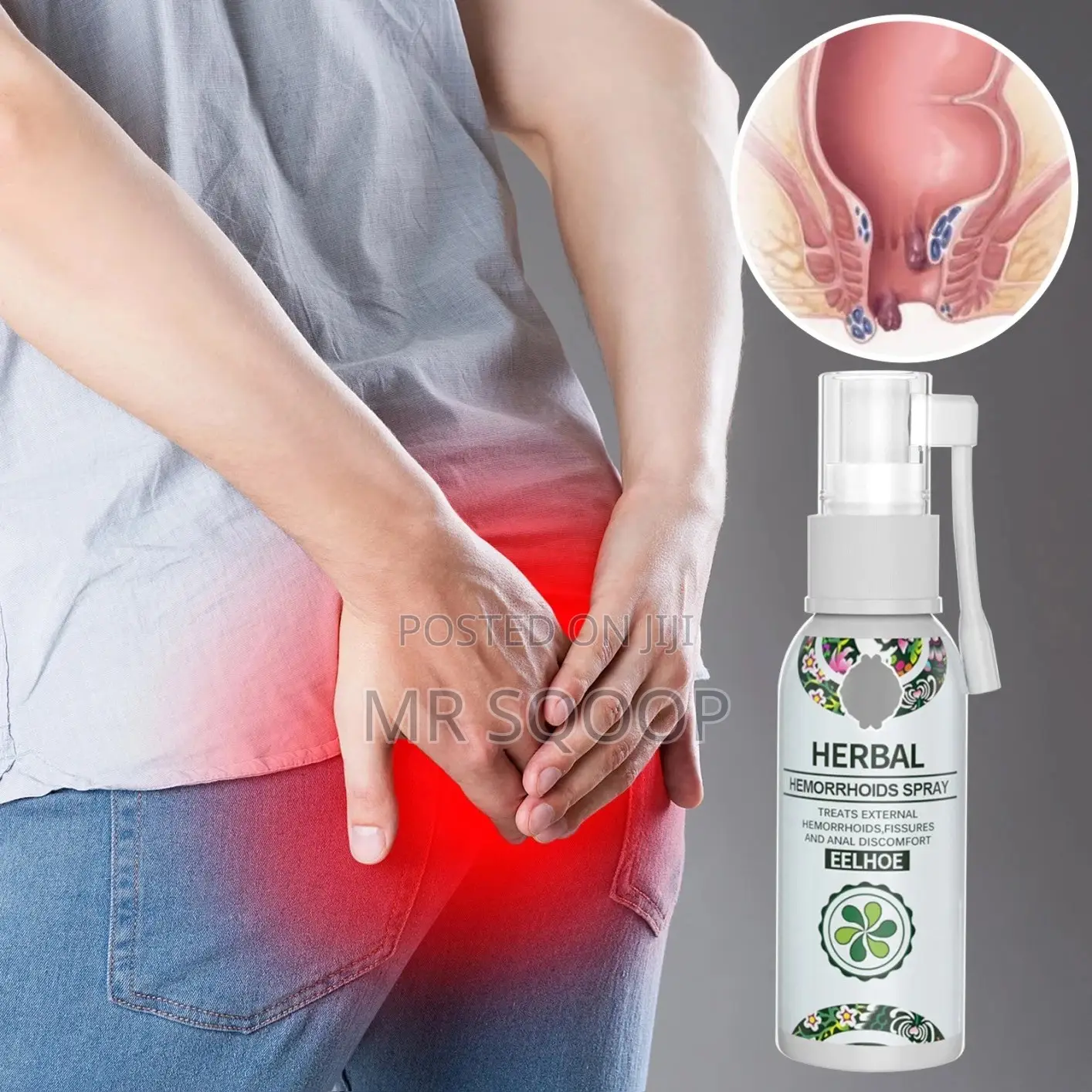 Herbal Hemorrhoids Spray for Piles, Anal Fissures Itching Relief