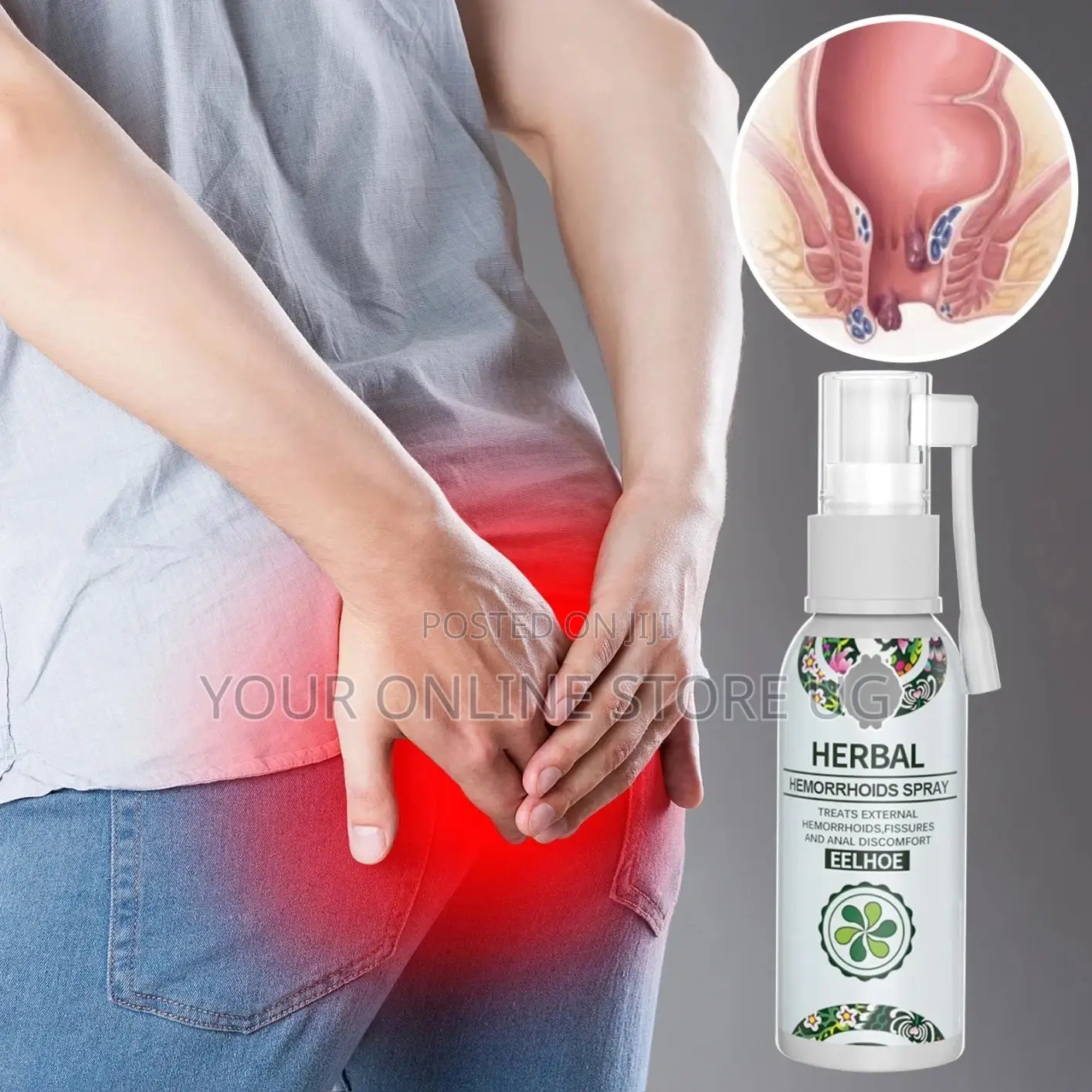 Herbal Hemorrhoids Spray for Piles, Anal Fissures Itching Relief