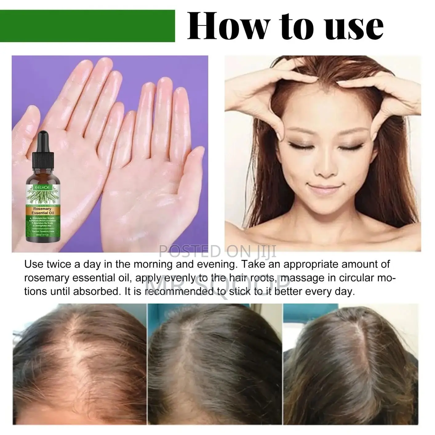 Rosemary Essential Oil for Hair Growth Scalp Care – 30ml
