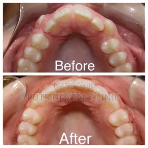 For All Your Dental Probrems