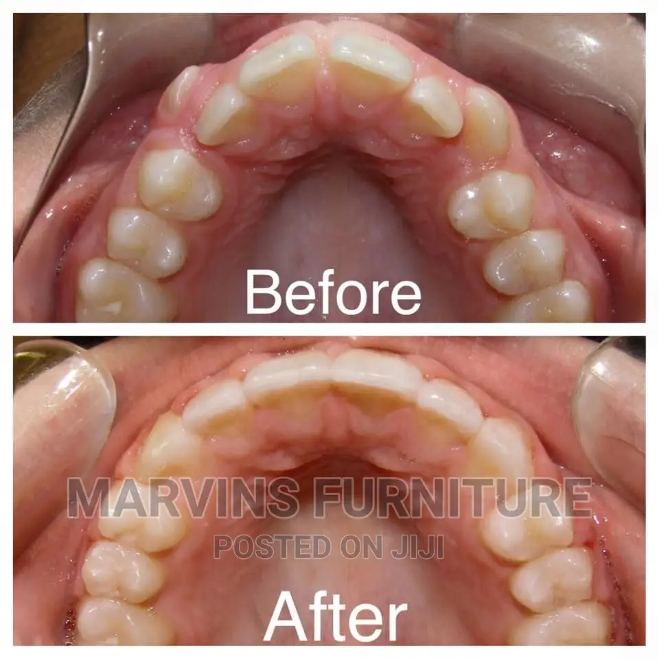 For All Your Dental Probrems