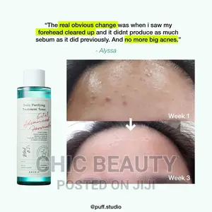 AXIS - Y - Daily Purifying Treatment Toner for Acne, Spots
