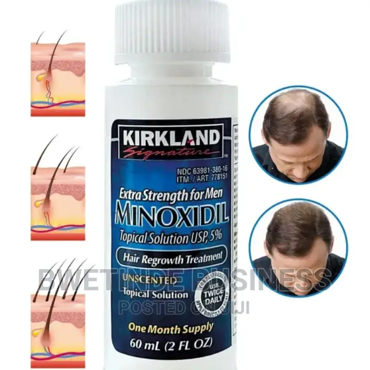 Kirkland Minoxidil 5% Hair Growth Treatment