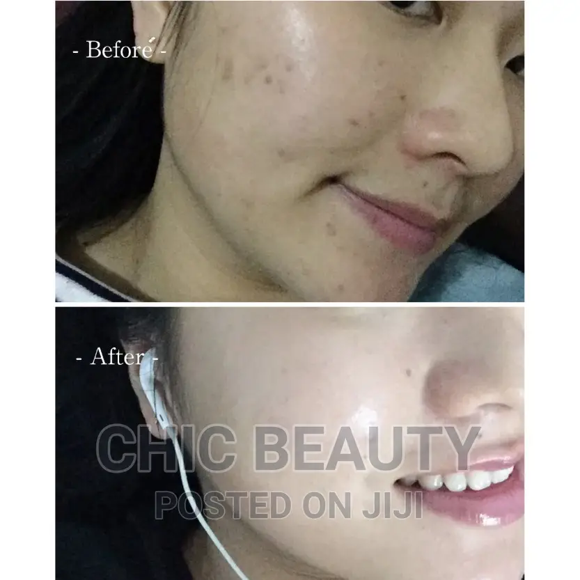 Rhoto Melano Cc Vitamin C Serum Tone Up Skin, Removes Dark Spots
