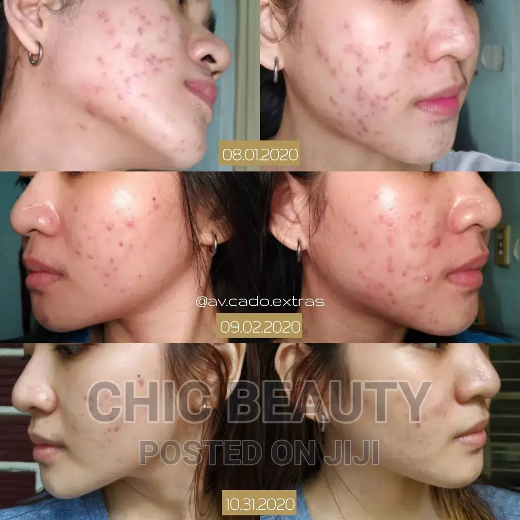 Rhoto Melano Cc Vitamin C Serum Tone Up Skin, Removes Dark Spots