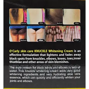 O'Carly Skin Care 5days Dark Knuckle Remover Whitening Cream