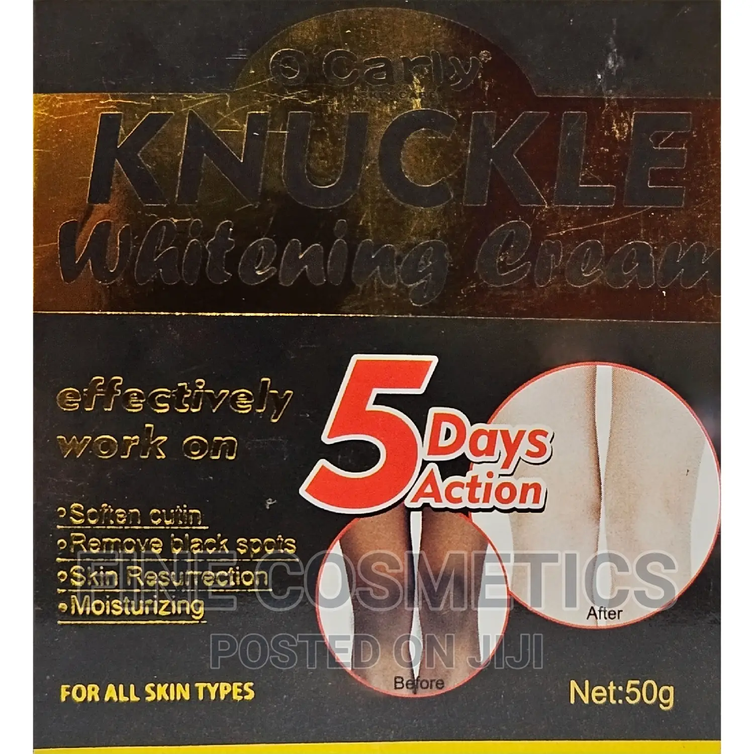 O'Carly Skin Care 5days Dark Knuckle Remover Whitening Cream