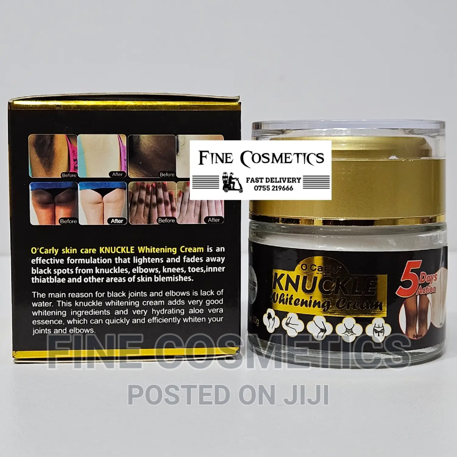 O'Carly Skin Care 5days Dark Knuckle Remover Whitening Cream